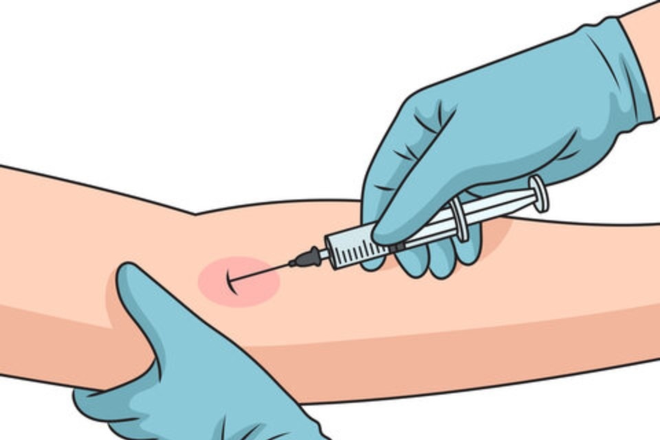 IV Injection